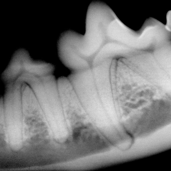 Digitale dentale röntgen